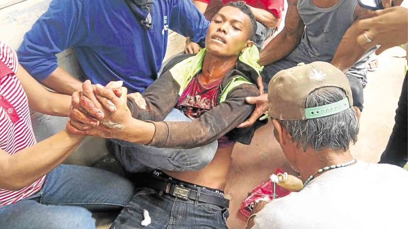 FIGHTING FOR DEAR LIFE   A wounded protester holds on to dear life after police in Kidapawan City fired shots to disperse thousands of drought-stricken farmers blocking the national highway to demand rice from government. Three farmers died in the dispersal.            KILUSANG MAGBUBUKID NG PILIPINAS